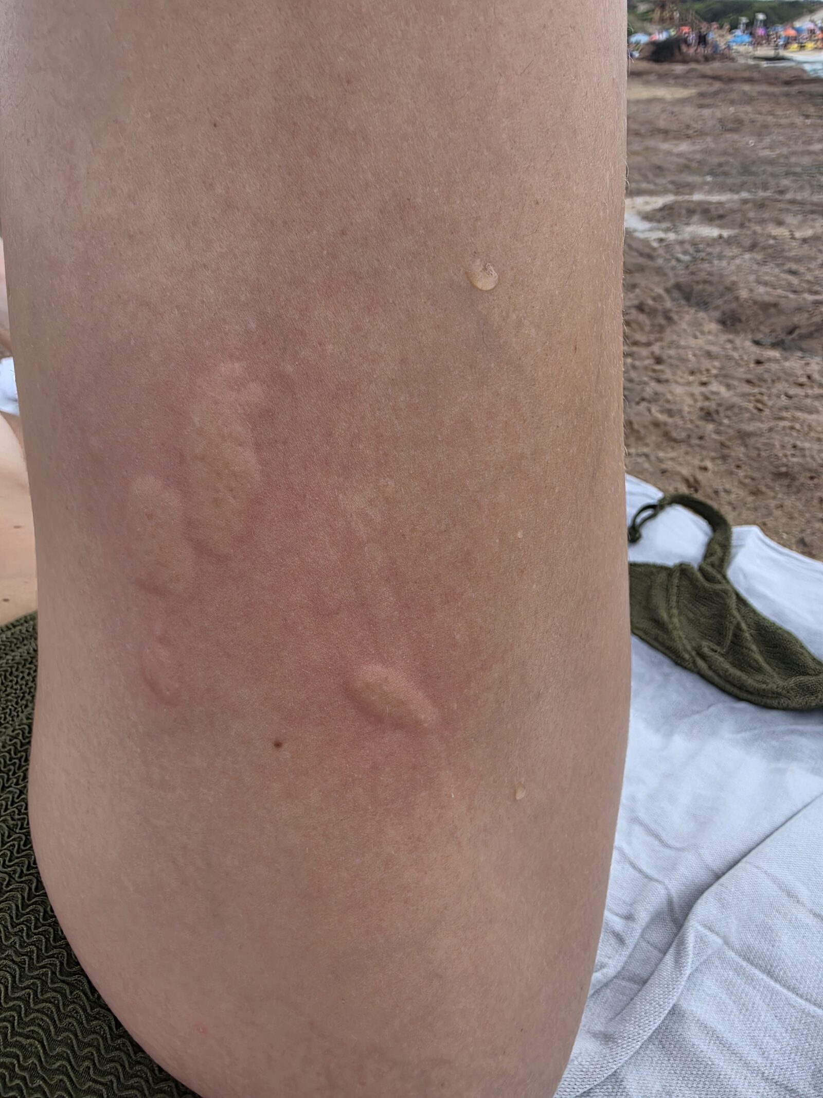 Pelagia Noctiluca